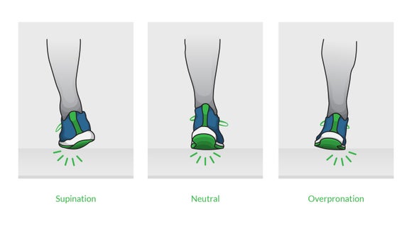 Diagram explaining supination, neutral, and overpronation.