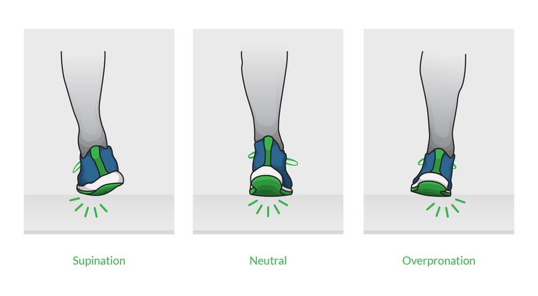 Diagram explaining supination, neutral, and overpronation.