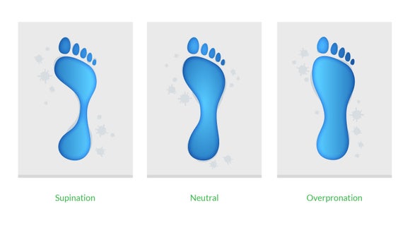 The wet foot test is a simple way to gauge your level of pronation